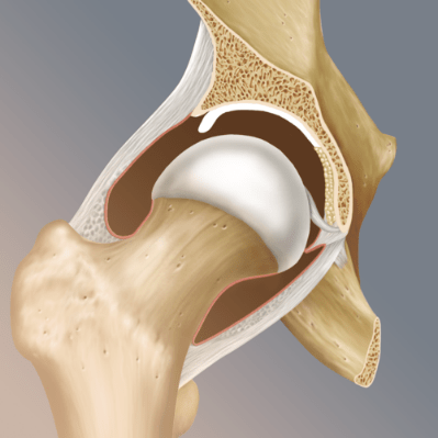 Labral Tear