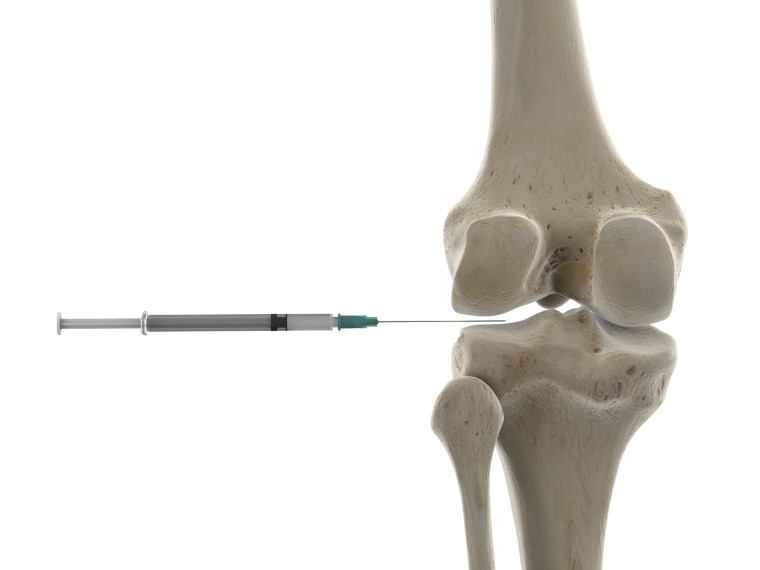 knee injections for arthritis