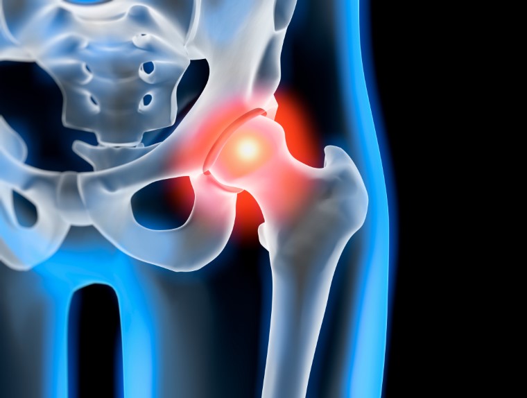 hip arthroscopy treatment