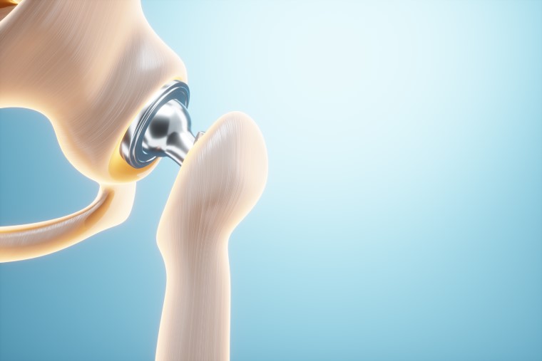 hip replacement specialist melbourne