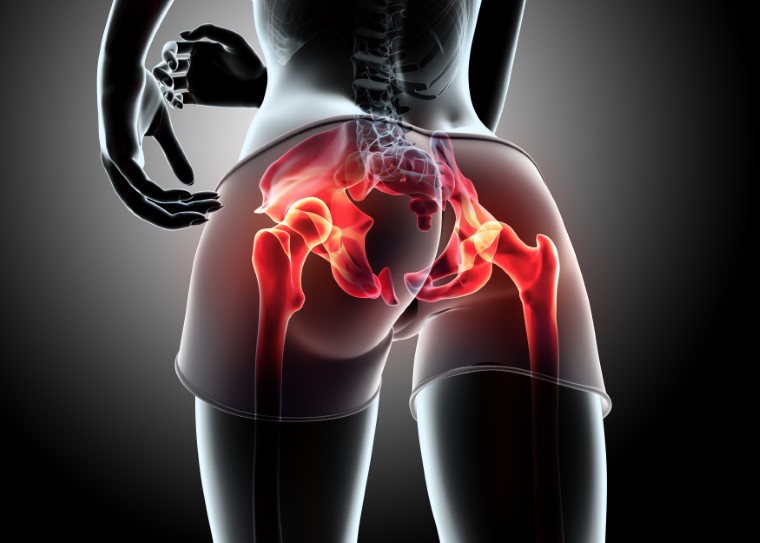 Treatment For Hip Bursitis and Causes Melbourne