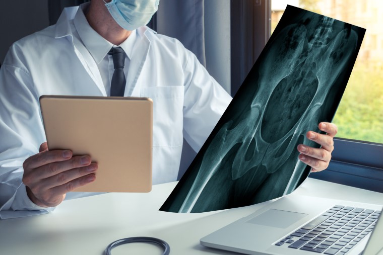 Robotic joint replacement - MOATI