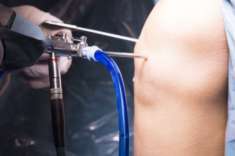 orthopaedic surgeon in kooyong - MOATI